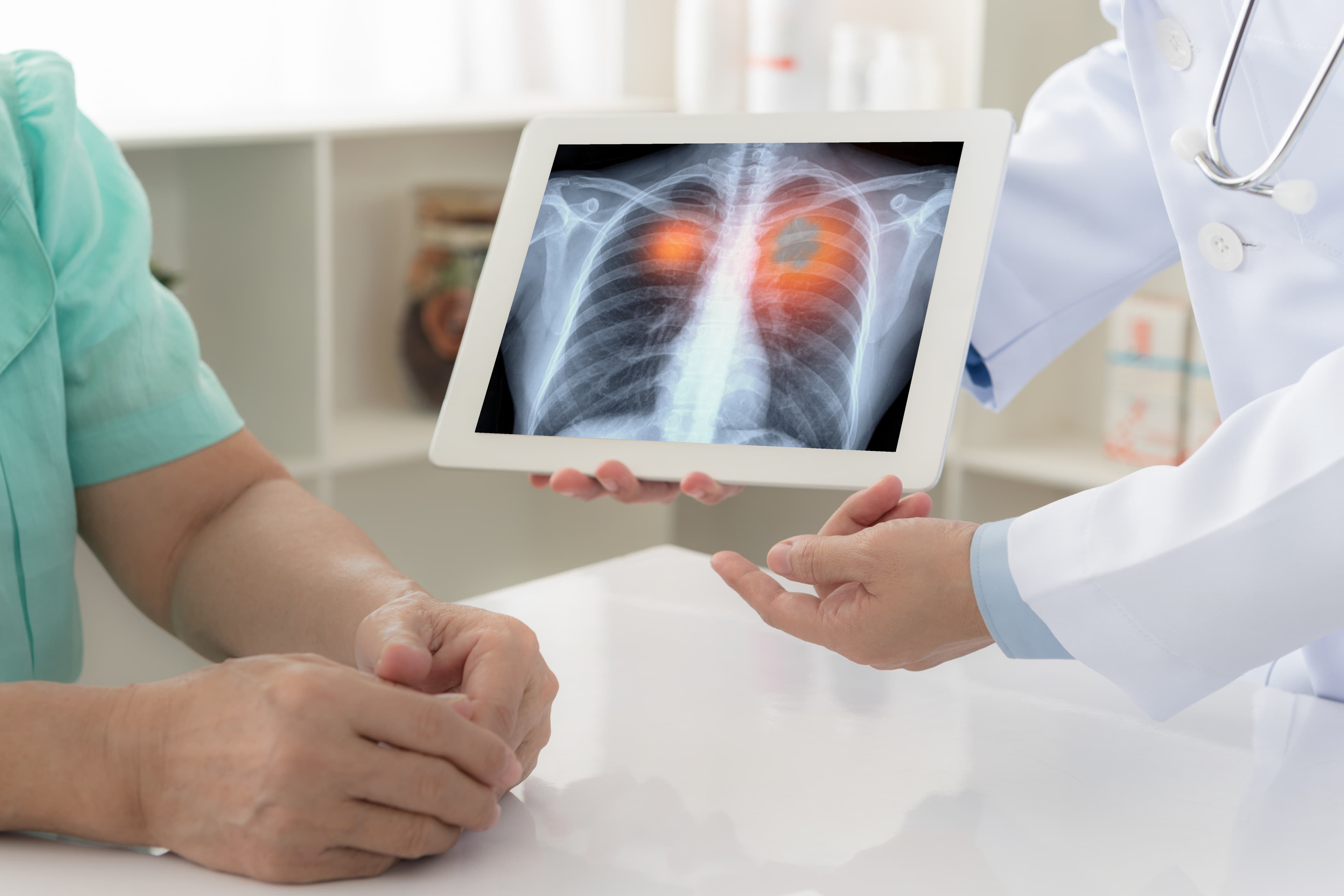 lung cancer concept. doctor explaining results of lung check up from x-ray scan chest on digital tablet screen to patient.